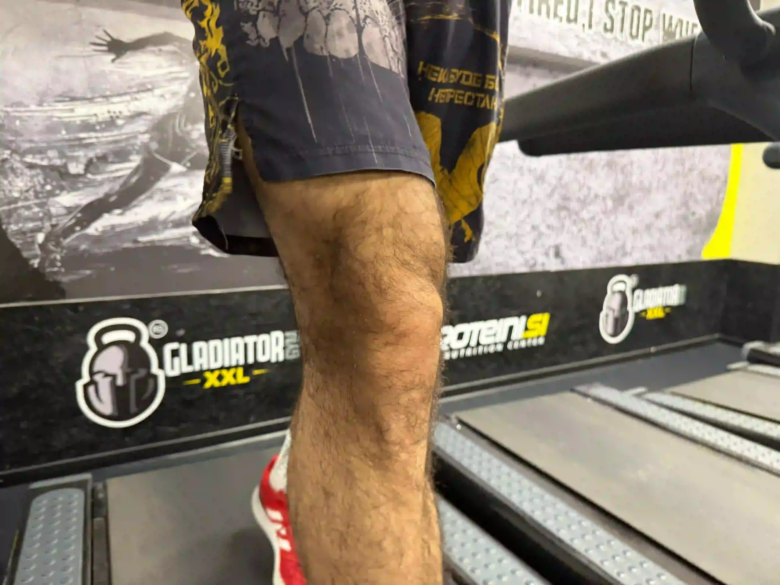 Close-up shot of a knee joint (patella) during a treadmill workout.