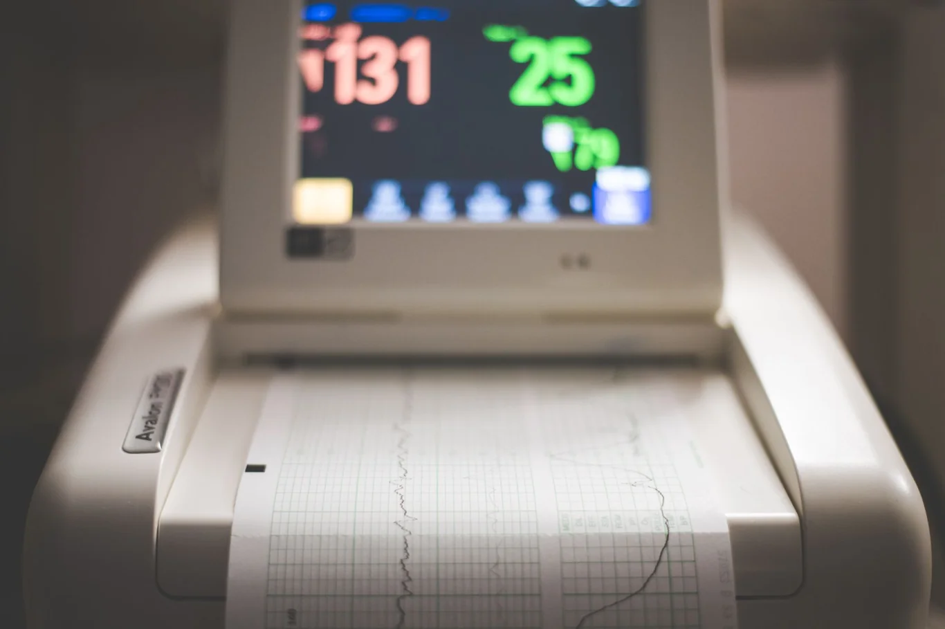 ECG machine printing a heart rate strip with a monitor displaying vital numbers in the background